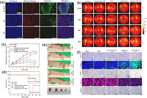 ◎ 腫瘤乏氧改善及腫瘤智慧光動力治療。
